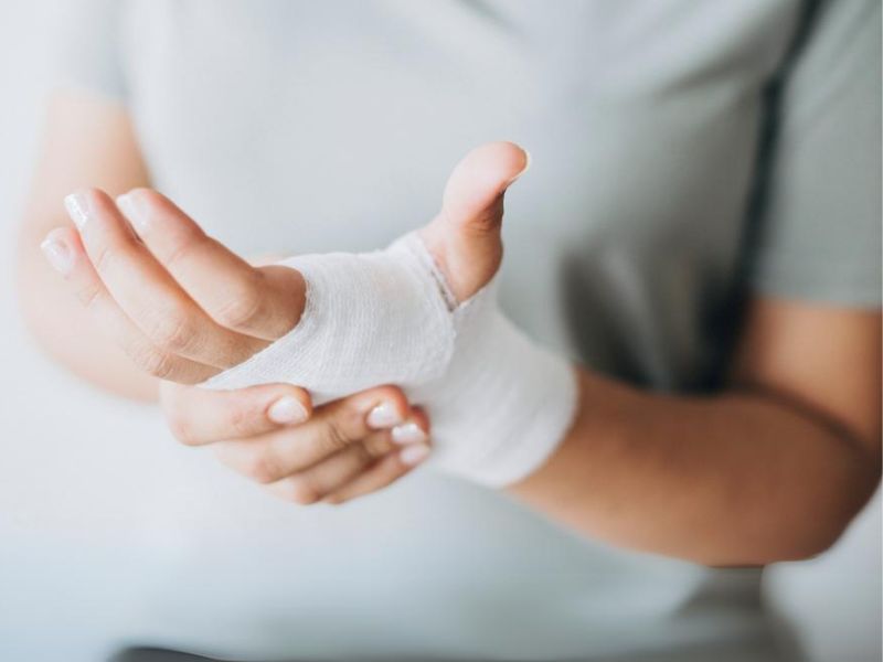 Fracture du scaphoÃ¯de