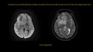 Question mycobactÃ©rium